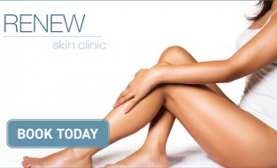 Summer is here treat yourself to Icoone/Endermologie Cellulite & Inch loss treatments.