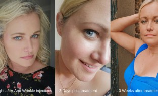 ANTI AGEING – A SERIES by Lorna Claire Weightman