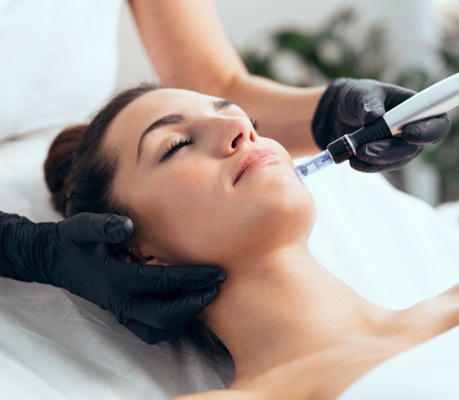 Microneedling Treatment Renew Aesthetic Clinic